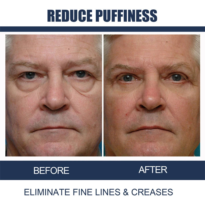 Men's Eye Cream Anti-wrinkle Remove Dark Circles Firming Eye Contour Skin Care Fades Fine Lines Moisturizing Korean Cosmetics