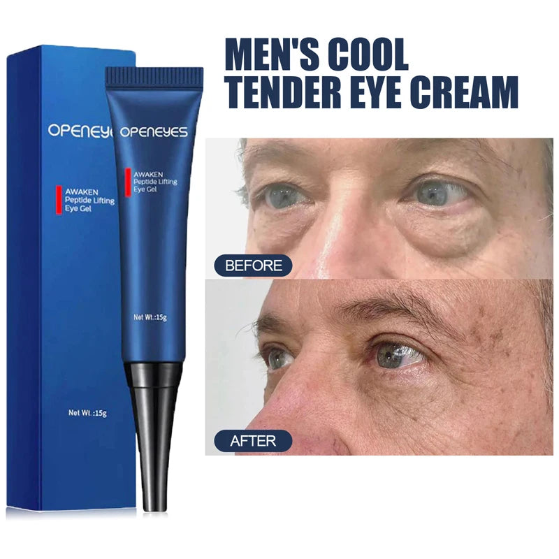 Men's Eye Cream Anti-wrinkle Remove Dark Circles Firming Eye Contour Skin Care Fades Fine Lines Moisturizing Korean Cosmetics